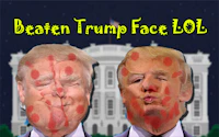 Beaten Trump Face LOL